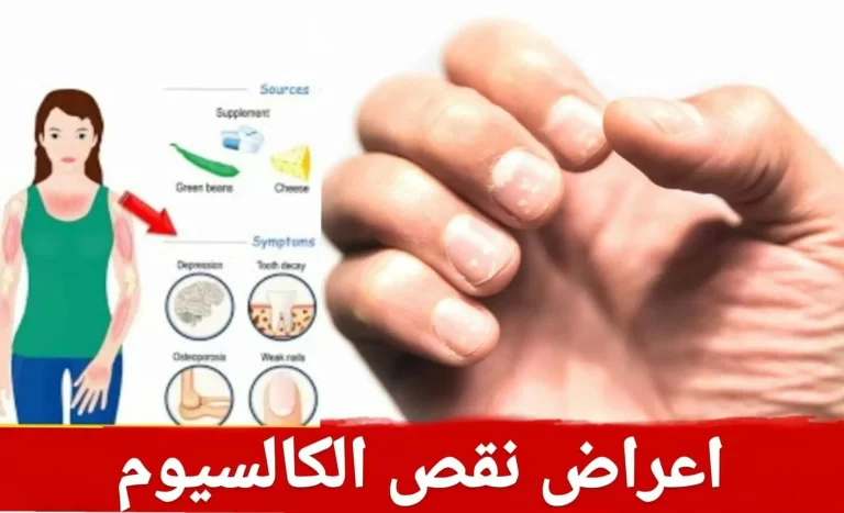 أعراض نقص الكالسيوم لدي الإنسان