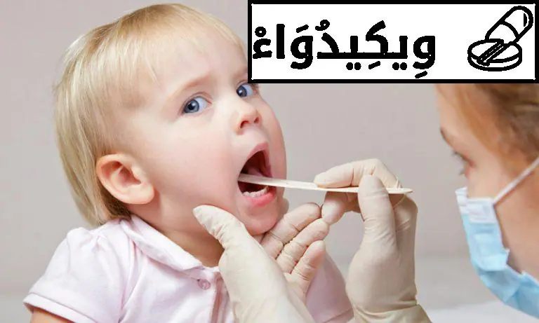 التهاب الحلق للاطفال