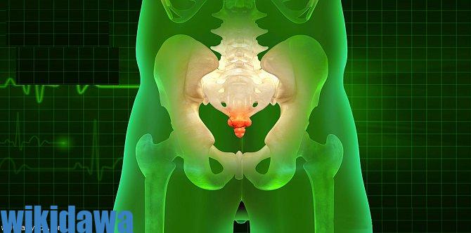 التهاب العصعص