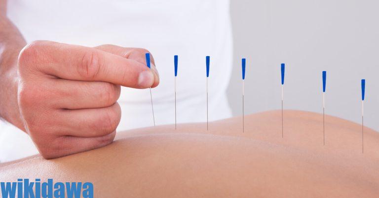 العلاج بالإبر الصينية تعرف على أهم فوائده وأضراره
