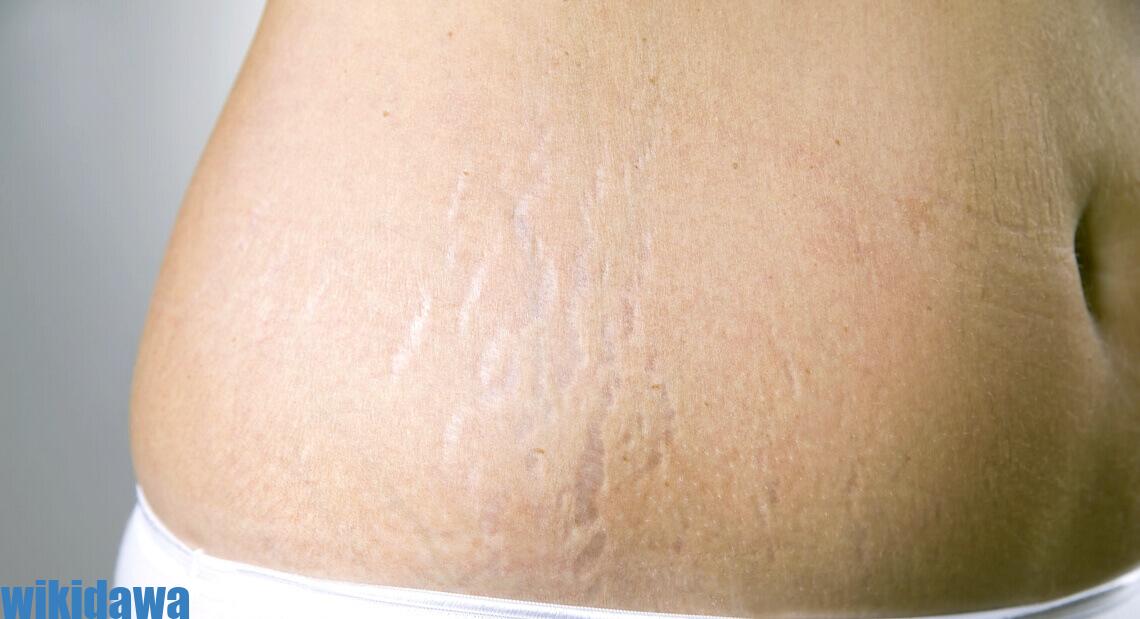 أسباب ظهور حبوب حمراء في جسم الحامل