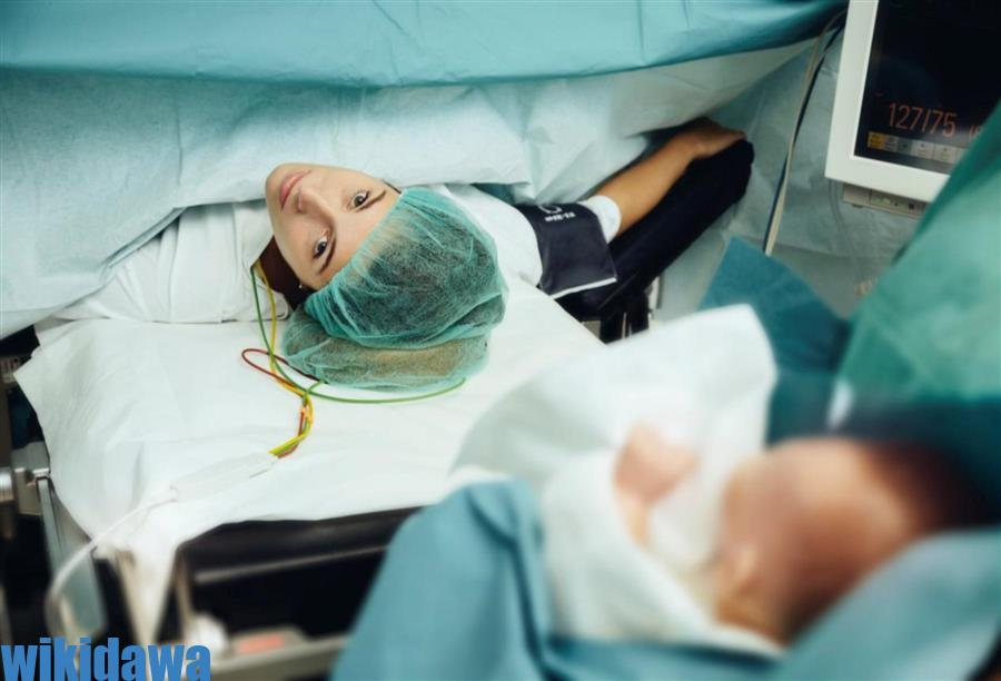 الولادة القيصرية