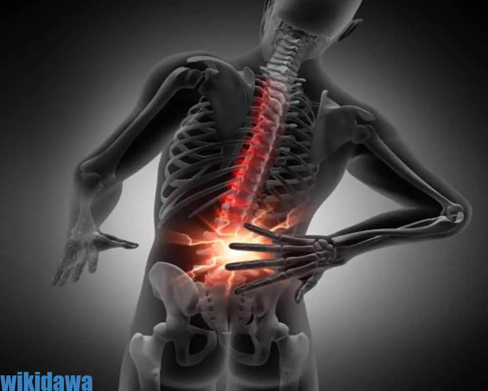 أبرز طرق علاج مشكلة الانزلاق الغضروفي